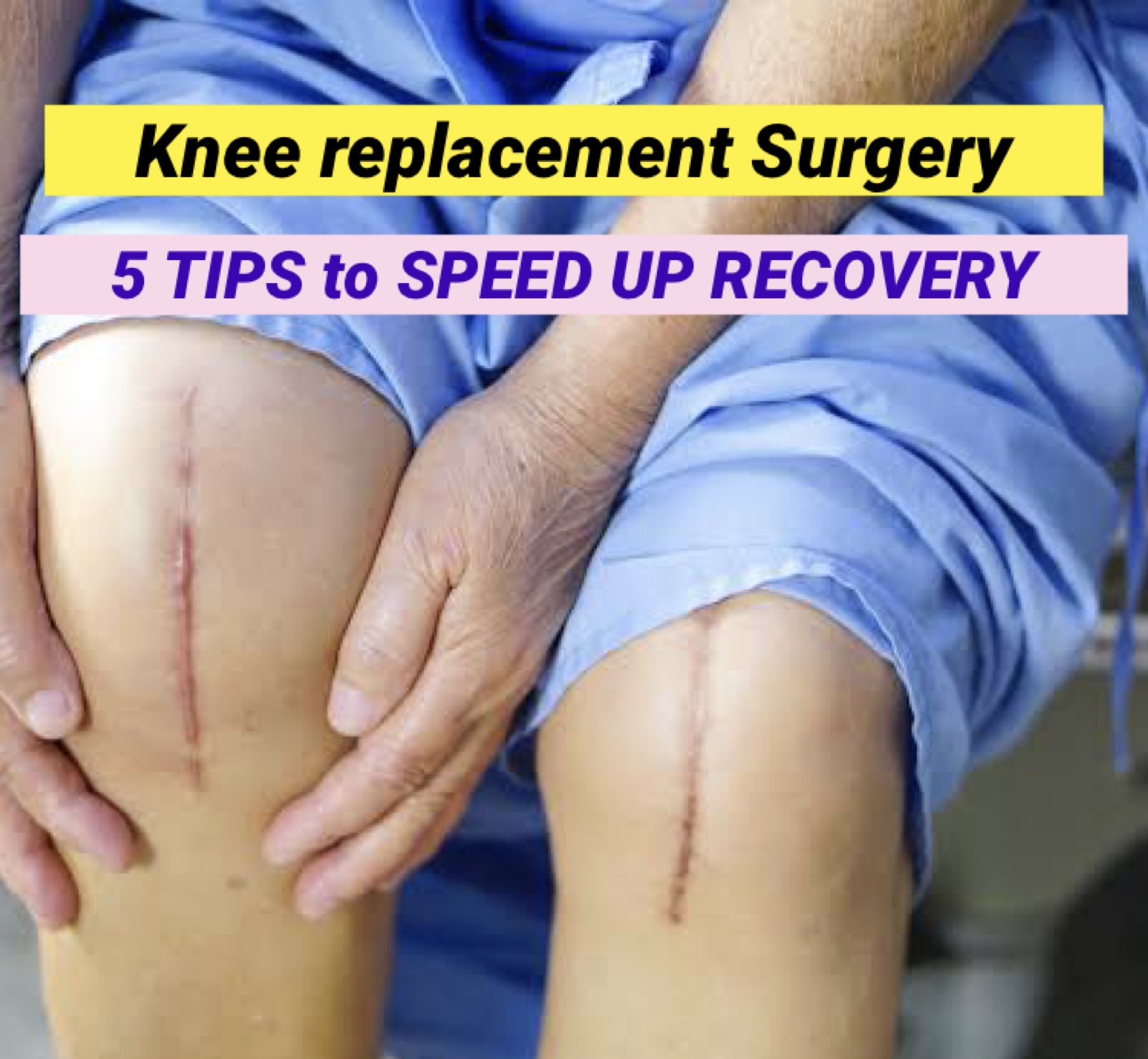 5 Tips To Speed Up Recovery After Total Knee Replacement Surgery